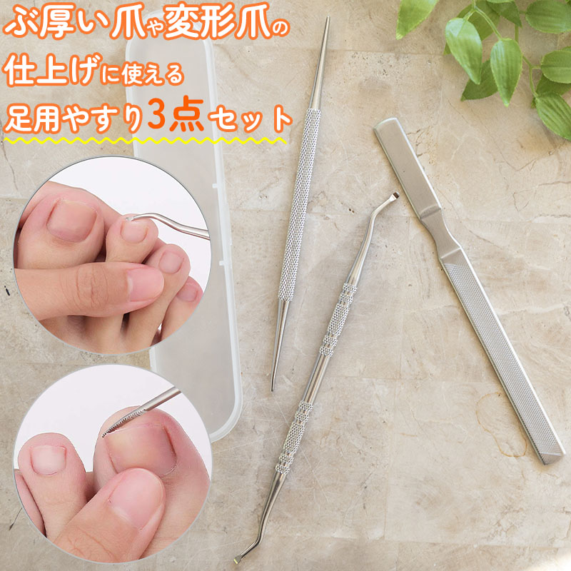 楽天市場】＼ネイルケア 3点セット／ 爪垢取り ゾンデ 爪垢 取り 変形
