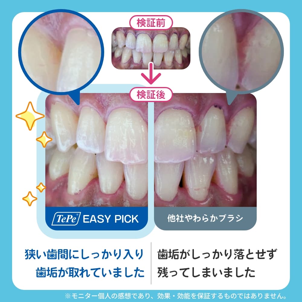 楽天市場】TePe テペ 歯間ブラシ イージーピック 1セット 36本+ケース