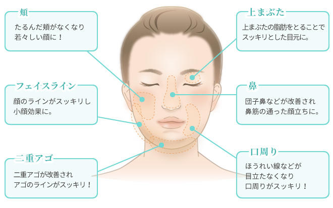 脂肪溶解注射カベリン（顔やせ）｜オザキクリニックLUXE 新宿院（目黒