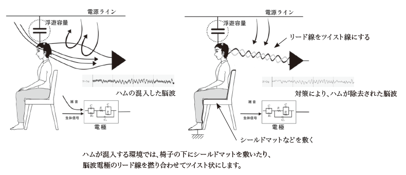テクニカルノート：数式を用いない 脳波解析入門