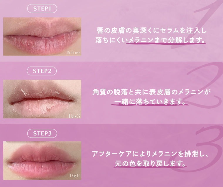 浜松市でローマピンク（Roma Pink）をお考えの方へ｜浜松市の女医