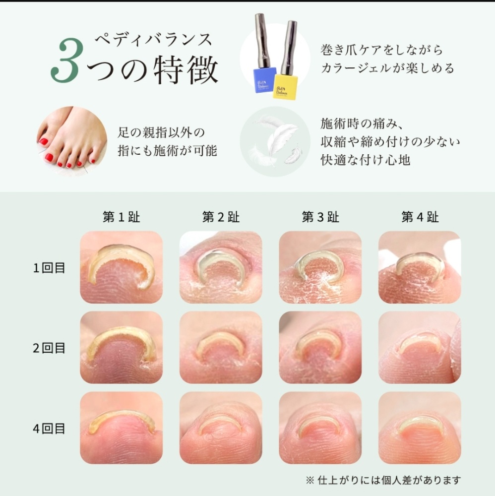 ペディバランスとは | 爪のトラブル専門 爪の万事屋™