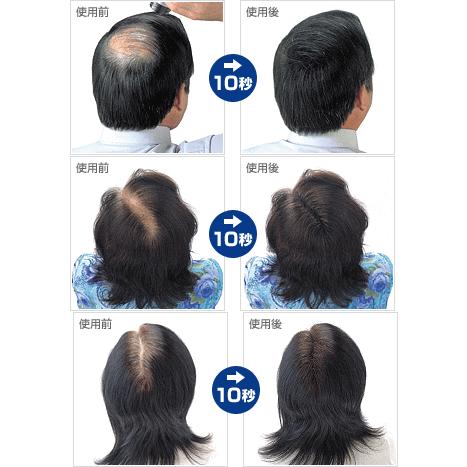 スーパーミリオンヘアー 30g(ブラック) : 愛らんどびゅーてぃ - 通販