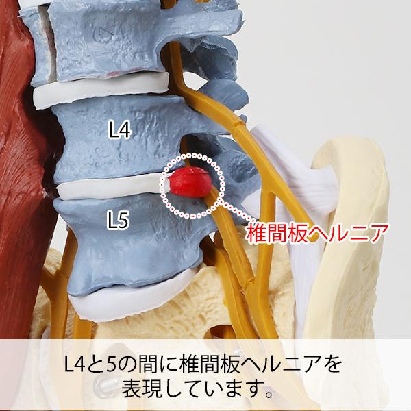 7ウェルネ 脊椎模型 人体模型 ( 主要筋 靭帯 神経 血管 付 ) 実物大