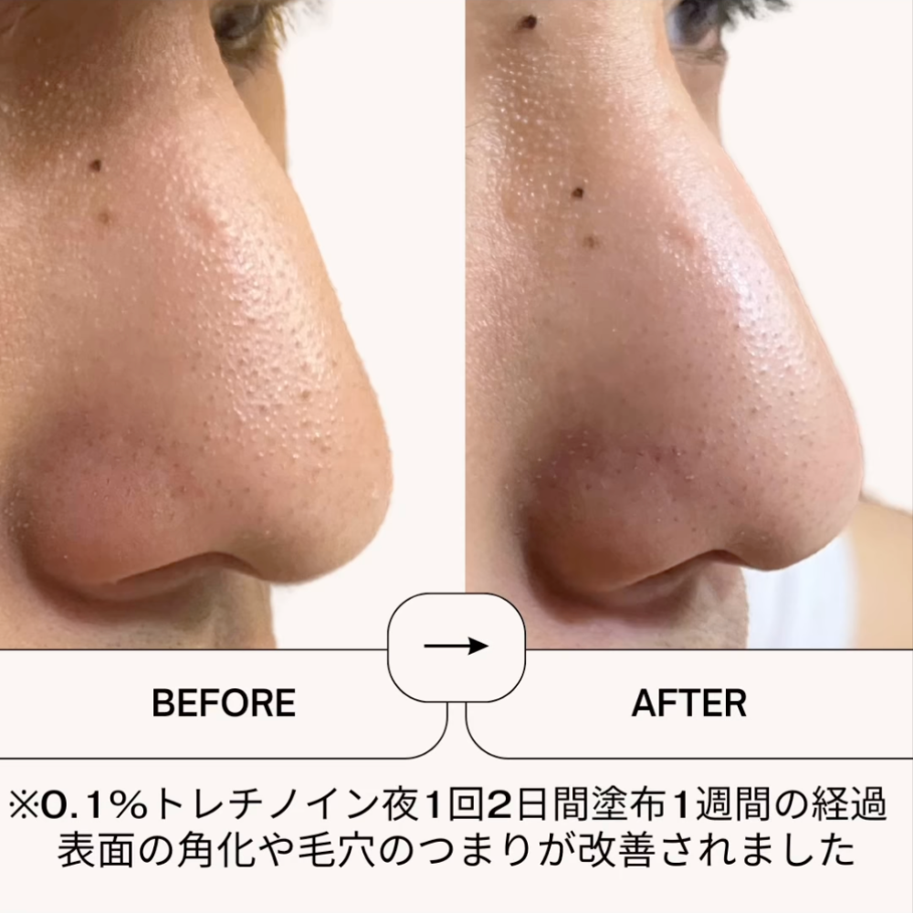 ゼオスキンヘルス スキンブライセラム 0.5（50ml） ※購入時には